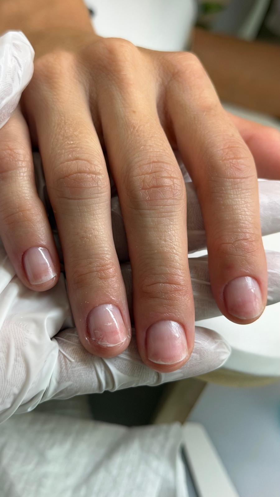 Nail Restoration with IBX by Keny Rohr